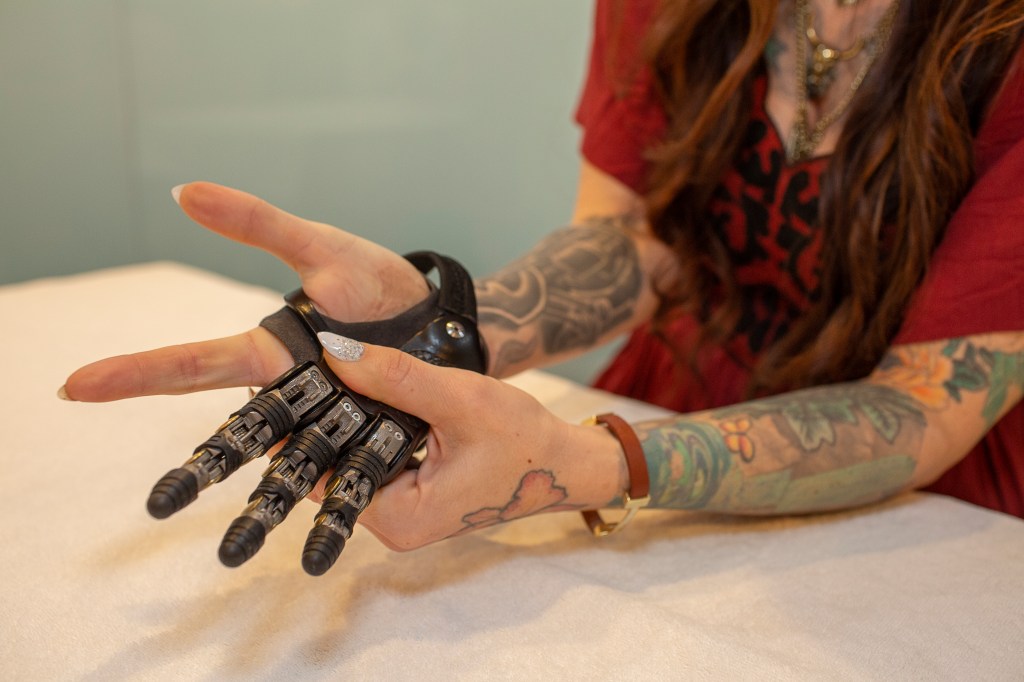 Person putting on prosthesis from Point Designs. 